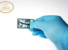 Dental plyonka