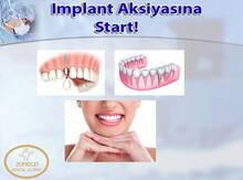 İmplant Aksiyası