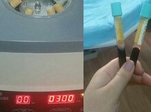 Kosmetoloji avadanlıq