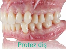 Protez dişlər