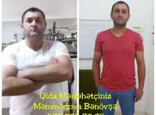 Arıqlamaq üzrə konsultasiya