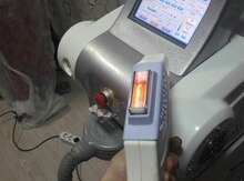 Lazer epilyasiya aparatı