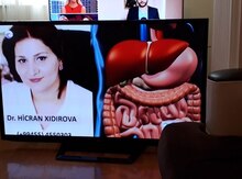Televizor "LG"