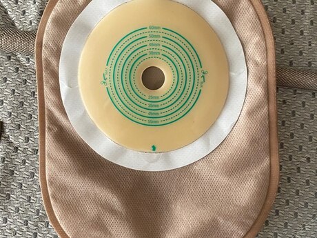 Stoma torbası