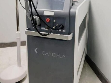 Lazer epilyasiya aparatı Candela