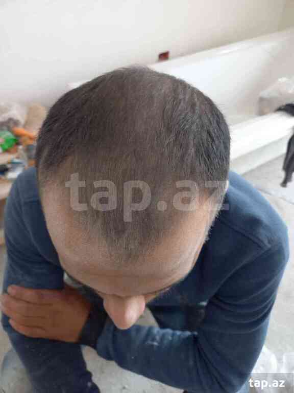Serum "Dermanew Hair"  (3)
