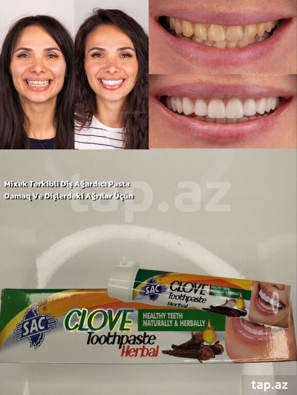 "Clove Toothpaste Herbal" diş məcunu