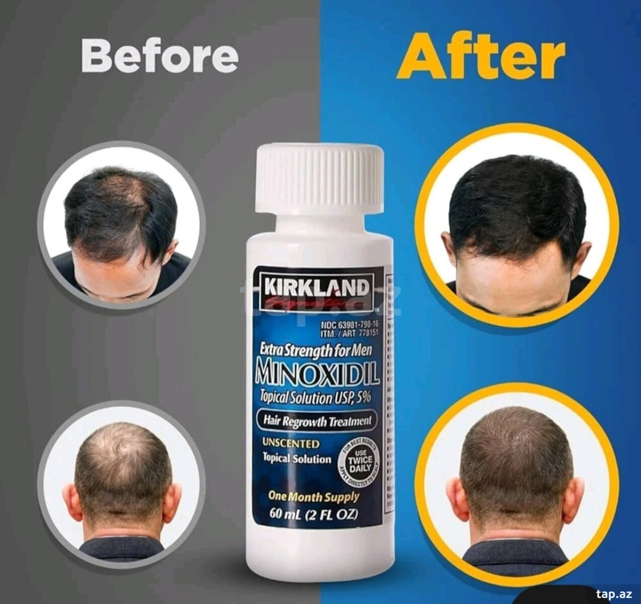 Minoxidil Kirkland 5% losyon 