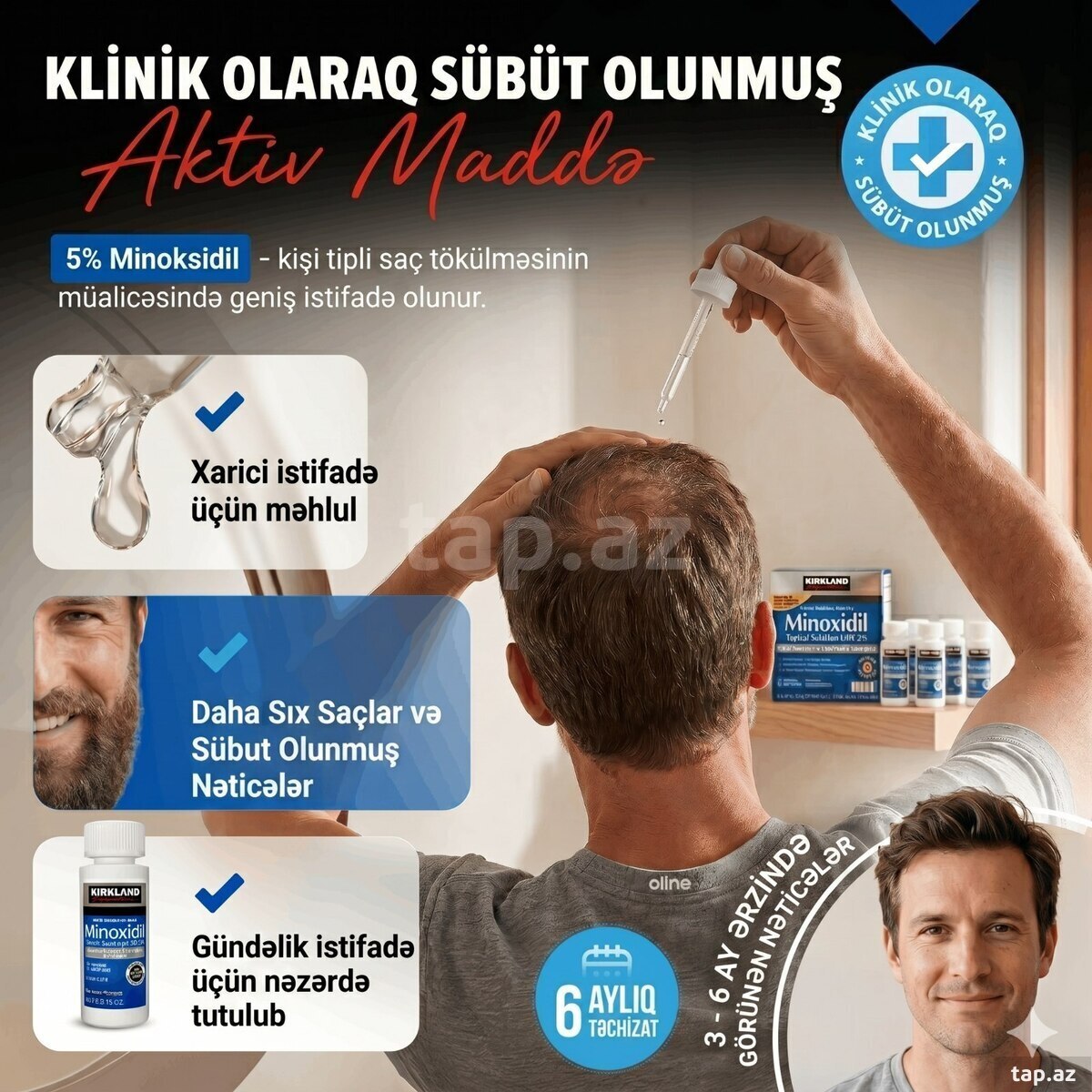 Minoxidil 5% (3)