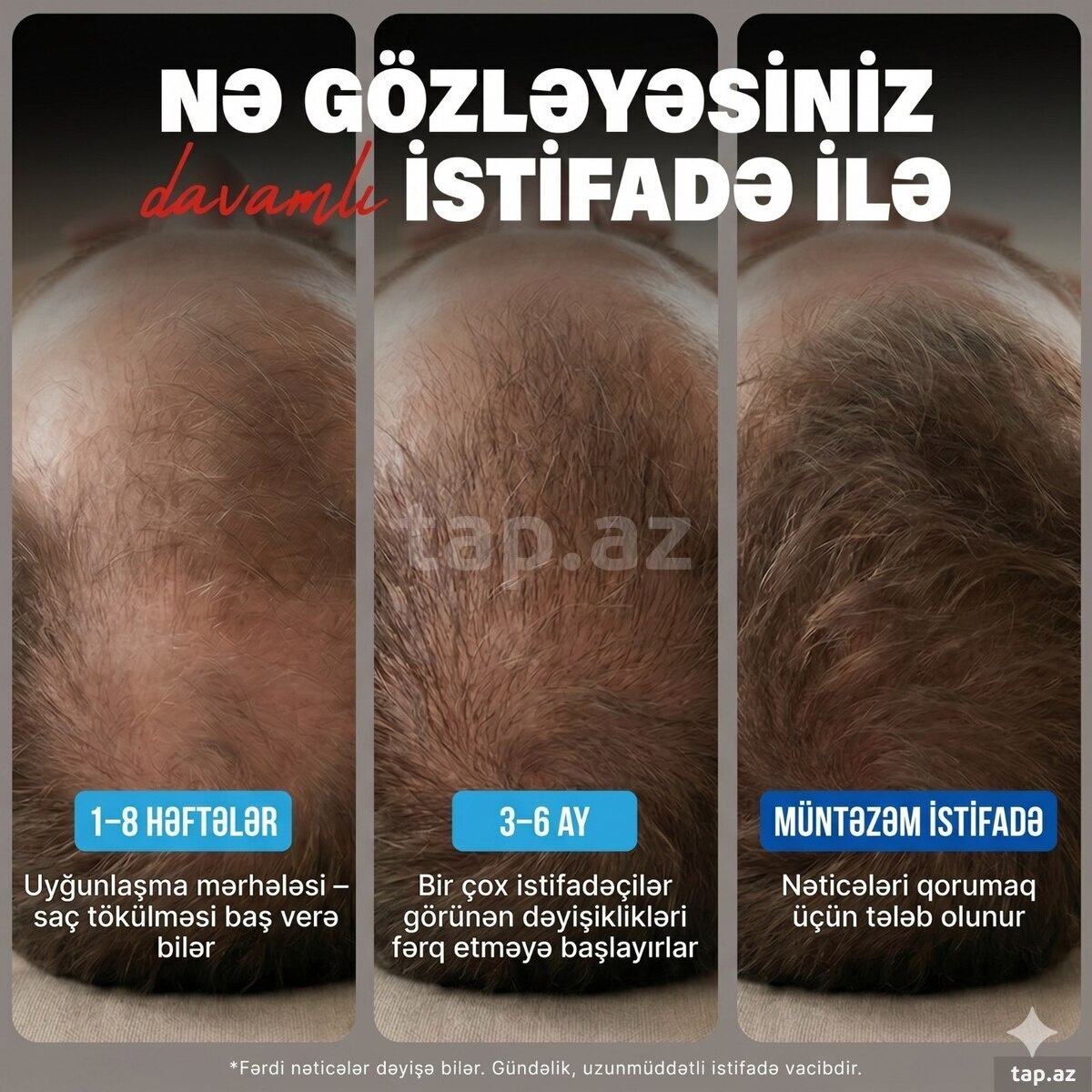 Minoxidil 5% (4)
