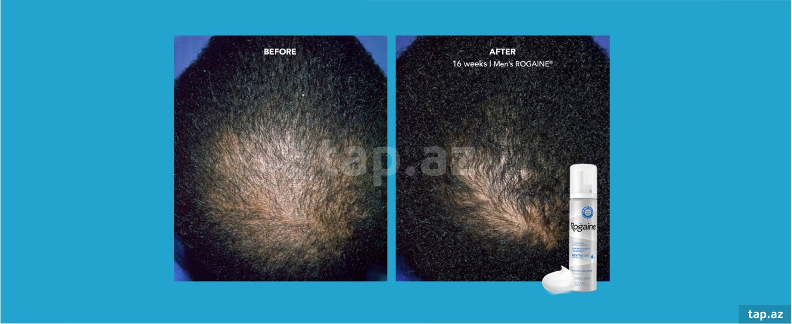 Rogaine 5% Minoxidil (9)