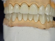 Diş texniki hazırlığı