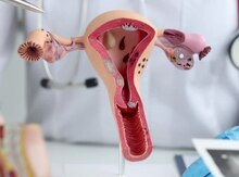 Endometrioz problemi və təbii müalicəsi
