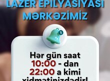 Lazer epilyasiyası xidməti 