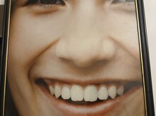 Fotoçərçivə